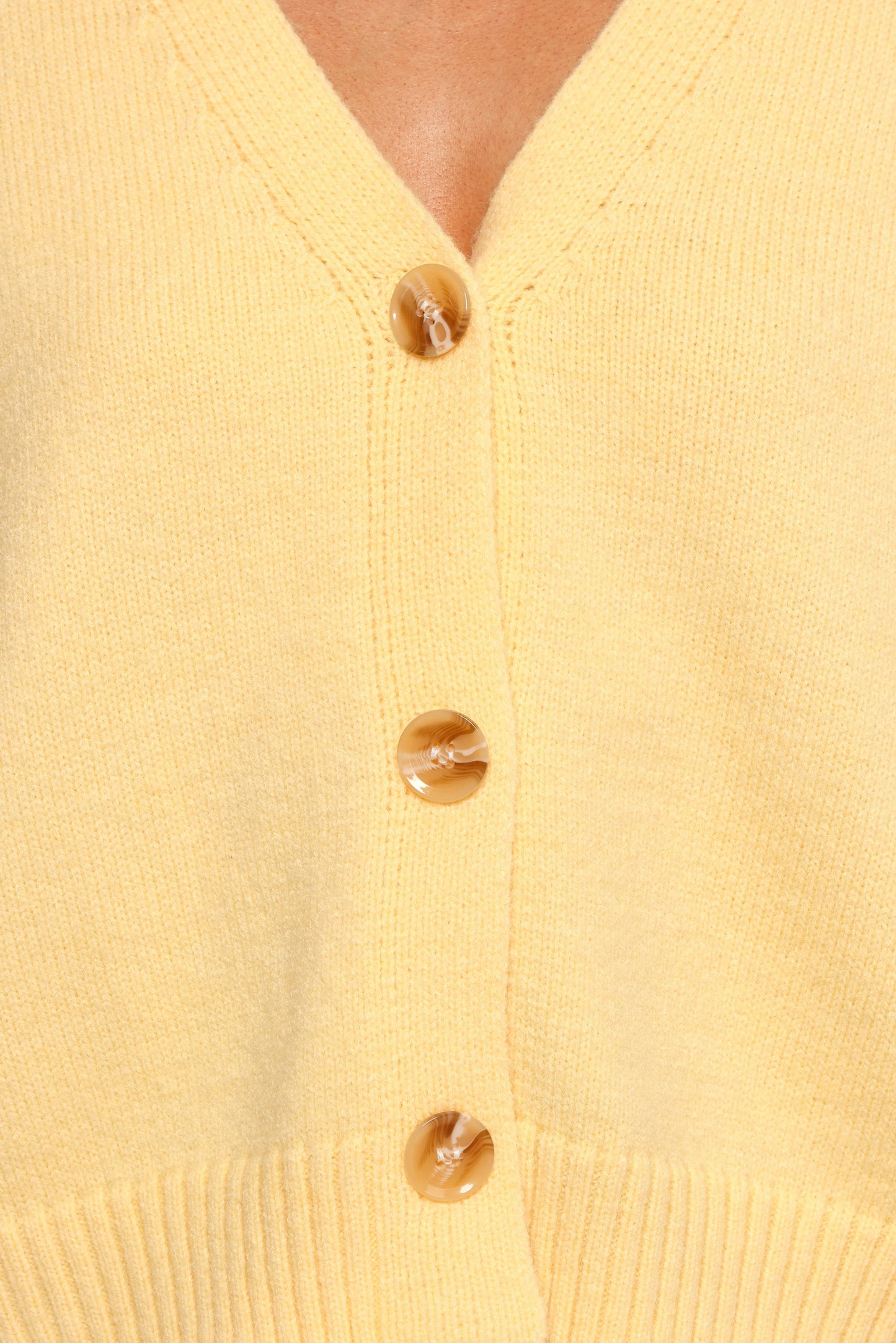 Isabel Button Front Cardigan Yellow